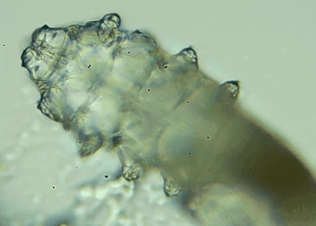 睫毛上驚現(xiàn)80只螨蟲(chóng)！別揉了，快自查下你的眼睛有沒(méi)有......